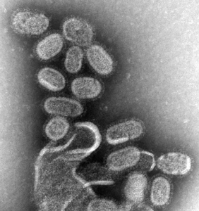 EM_of_influenza_virus